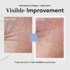 NOWATER Beta-glucan formula illustration highlighting soothing, moisturized under-eye skin.