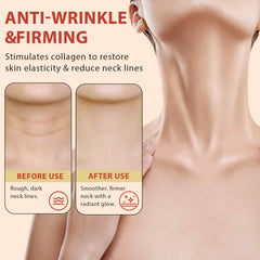 NQINQI neck-cream packaging with easy-to-use roller cap.