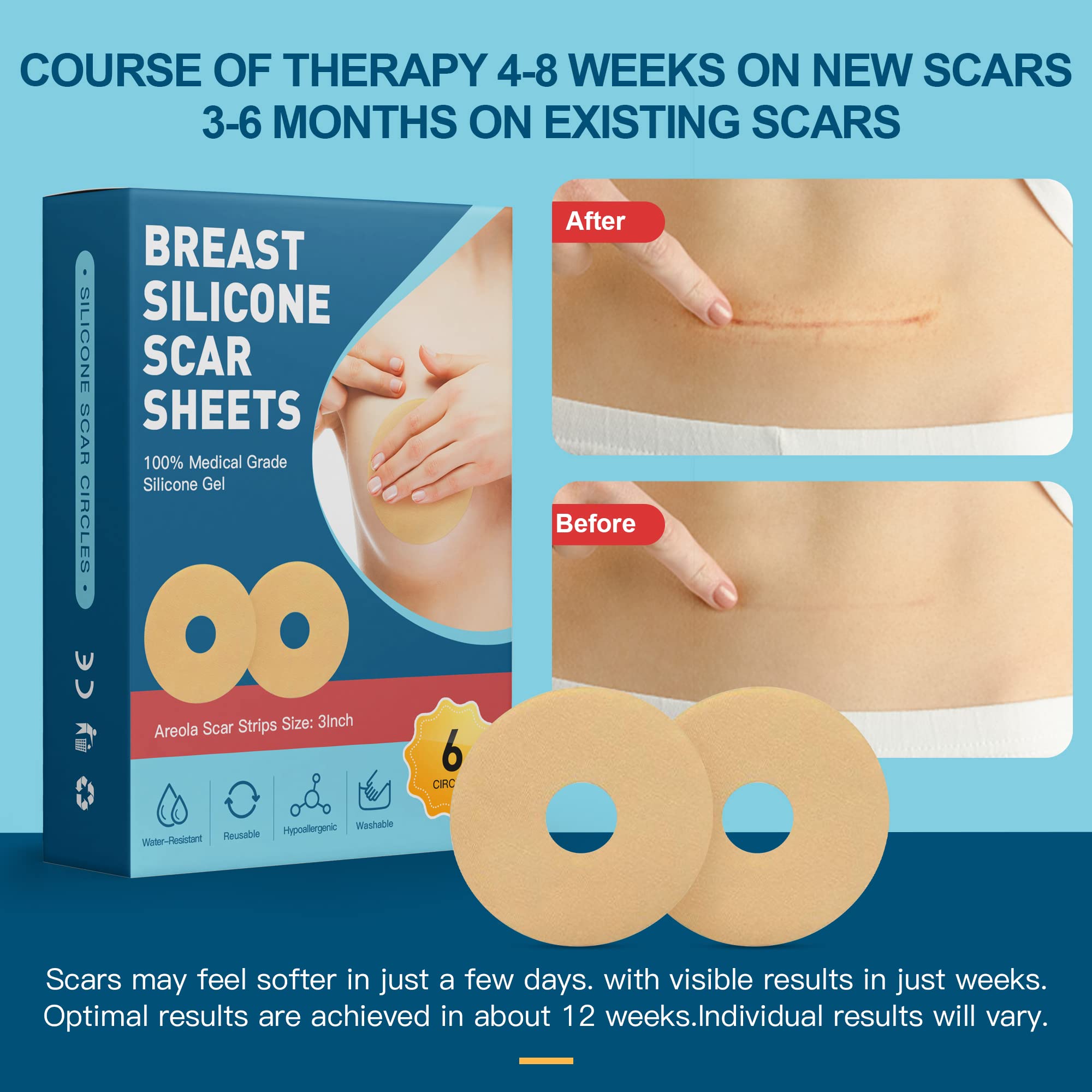 Nubical soft, flexible silicone offers gentle, breathable contact for scar management.