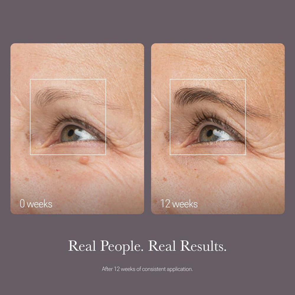 NULASTIN Clinically studied density appearance in a 12-week trial