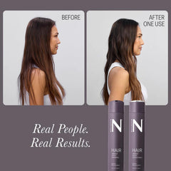 NULASTIN Elastaplex technology diagram explains root-level follicle support.