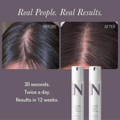 NULASTIN Scalp Serum applied on scalp for smooth absorption and nourishment