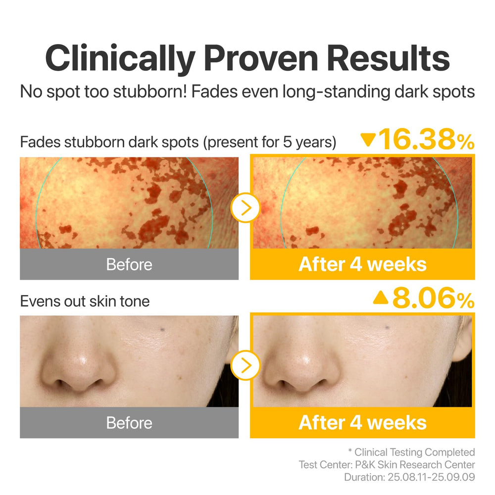Numbuzin No.5 product with Glutathione and Tranexamic Acid visuals.