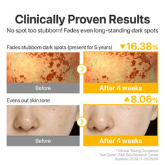 Numbuzin No.5 product with Glutathione and Tranexamic Acid visuals.
