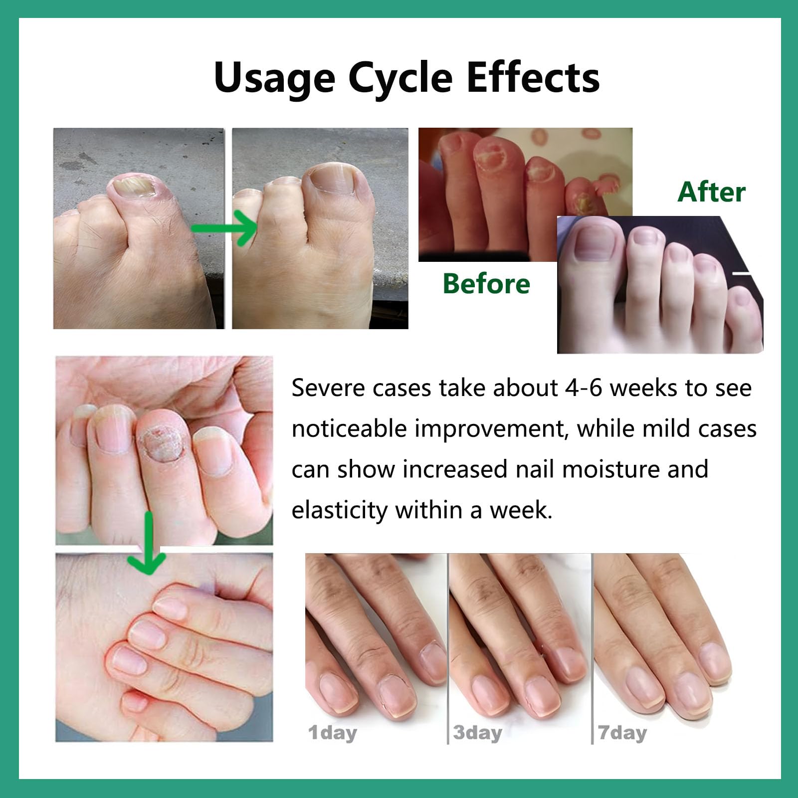 Nutraboost 20ml bottle front view for on-the-go nail care.