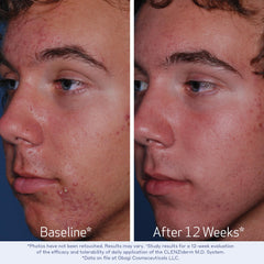 Obagi CLENZIderm MD packaging box showcases dermatologist-tested formulation.