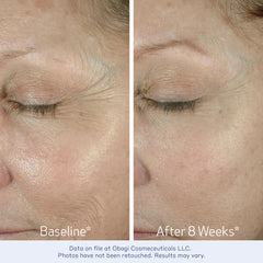 Obagi ELASTIderm Eye Cream dispenser pump shown for easy, precise application