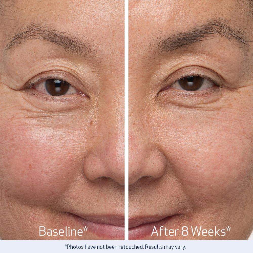 Obagi Nu-Cil brow before after shows potential improvements in fullness.