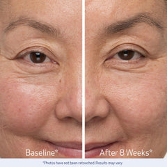 Obagi Nu-Cil brow before after shows potential improvements in fullness.