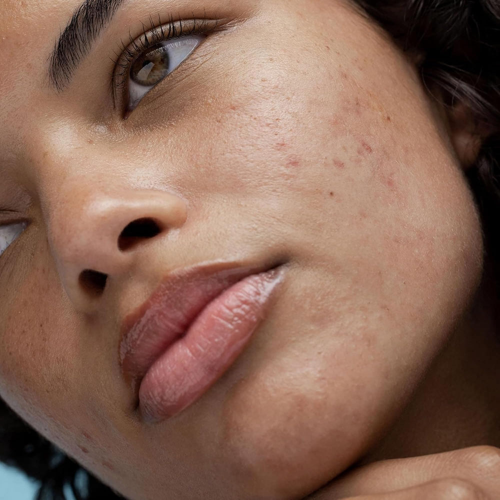 Obagi Rebalance skincare routine panel suggests barrier-friendly steps for calmer skin