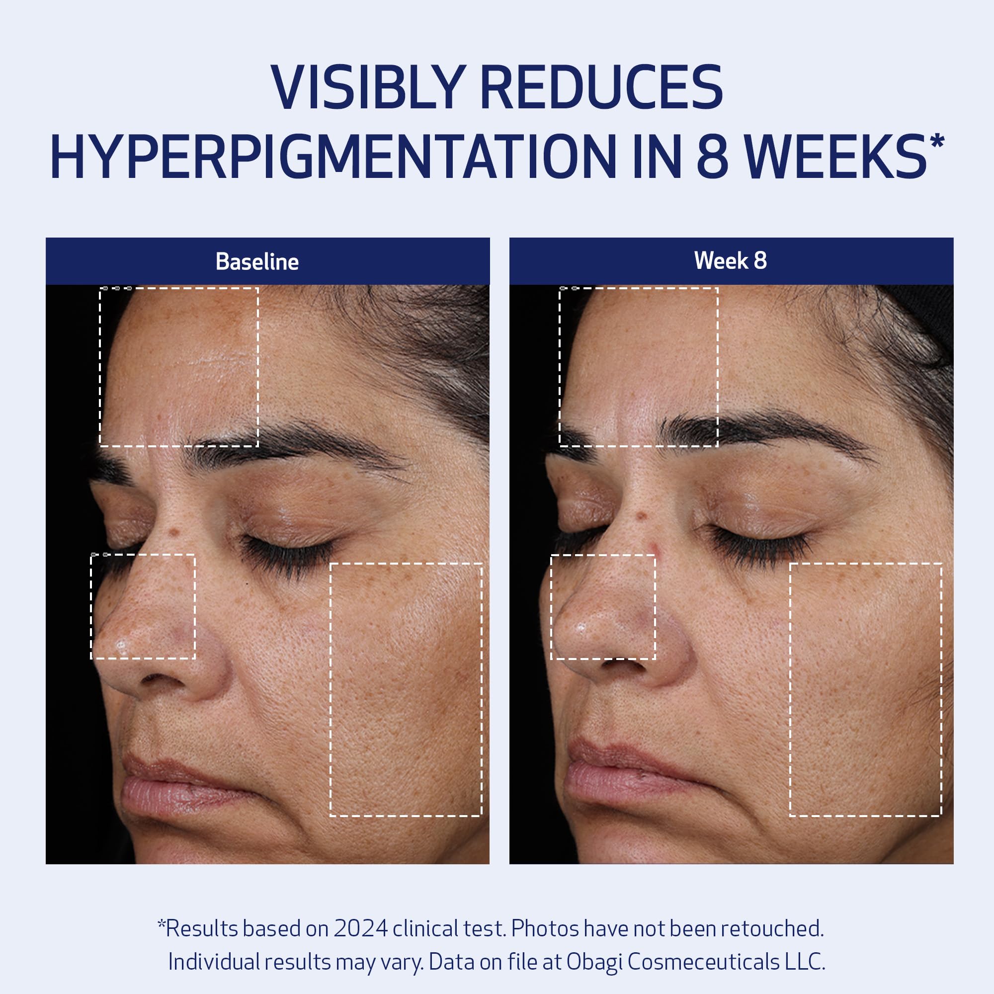 Obagi Claribright texture-focus suggests smoother skin over time
