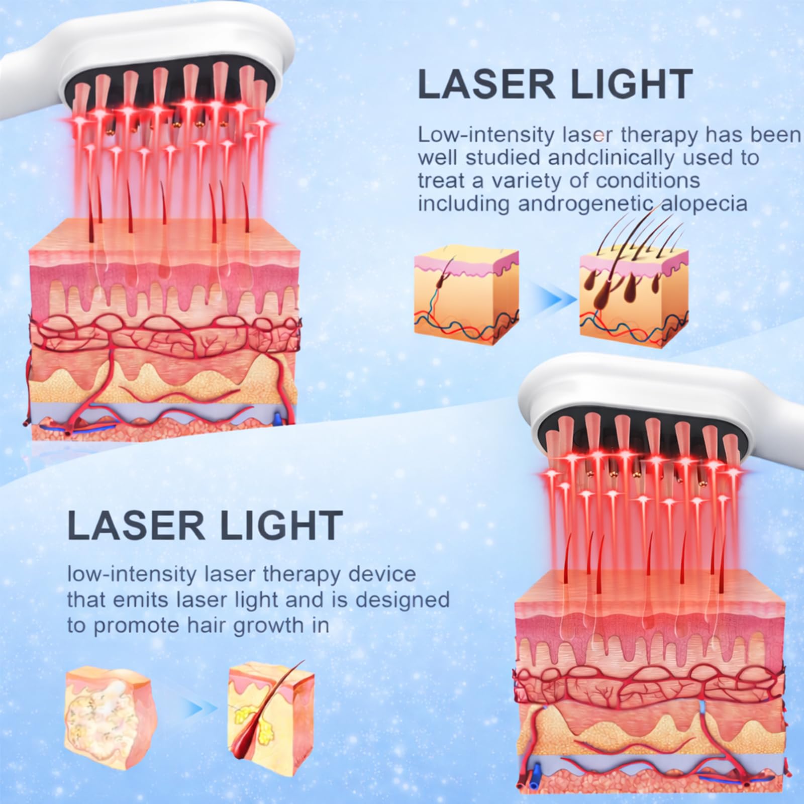 Obiredk Laser Growth Comb white, laser emitter visible for scalp exposure