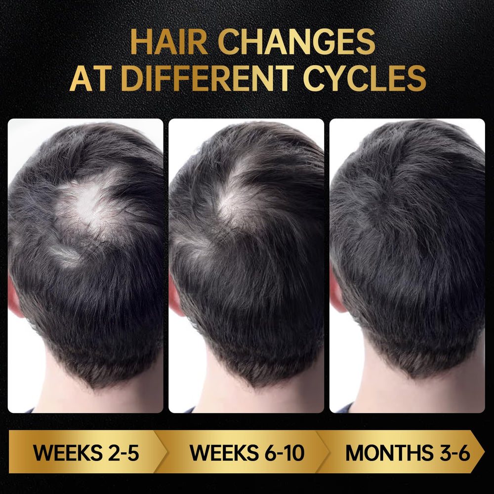 OCSINL Minoxidil biotin label close-up