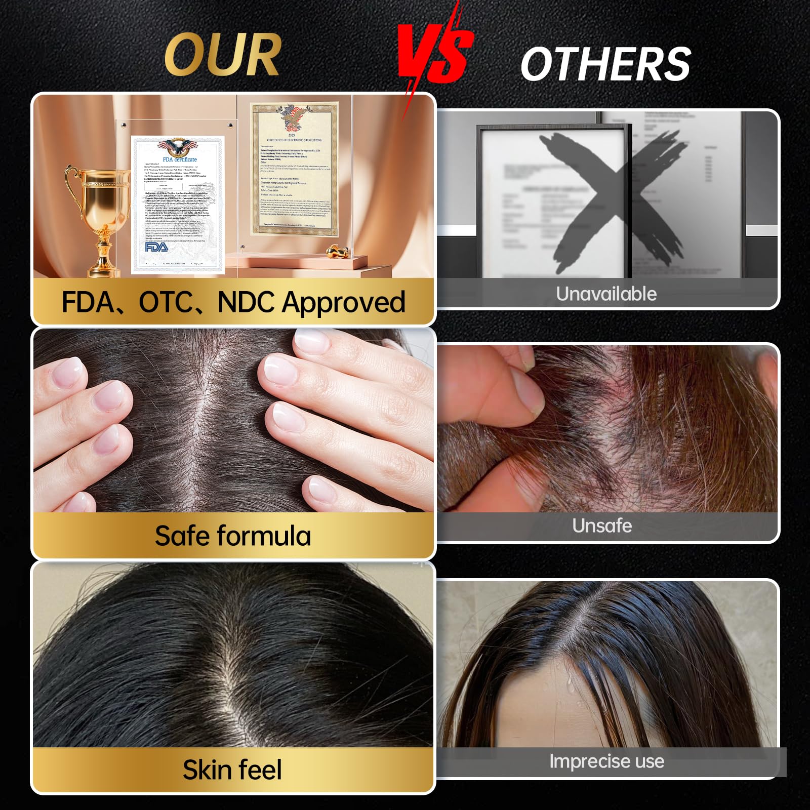 OCSINL Minoxidil hair regrowth close-up highlighting potential results