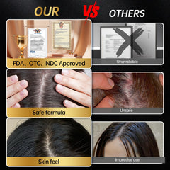 OCSINL Minoxidil hair regrowth close-up highlighting potential results
