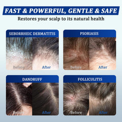 Oely shea butter jojoba oil moisturizing blend nourishes hair