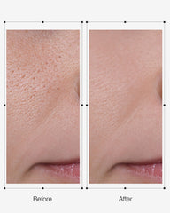 Rich foam of OGANACELL DERX Cleanser ready for even application