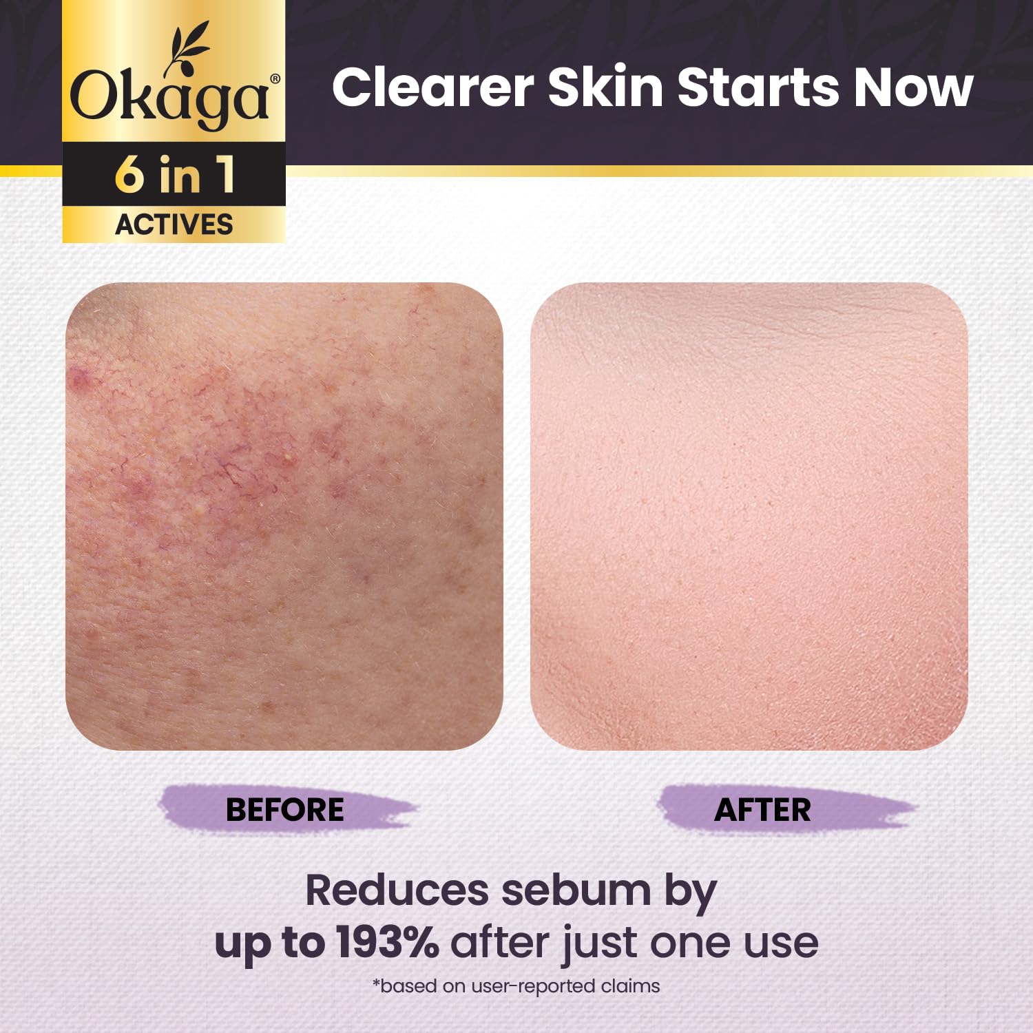 Okaga Argireline peptide action for firmer-looking skin and subtle plumpness