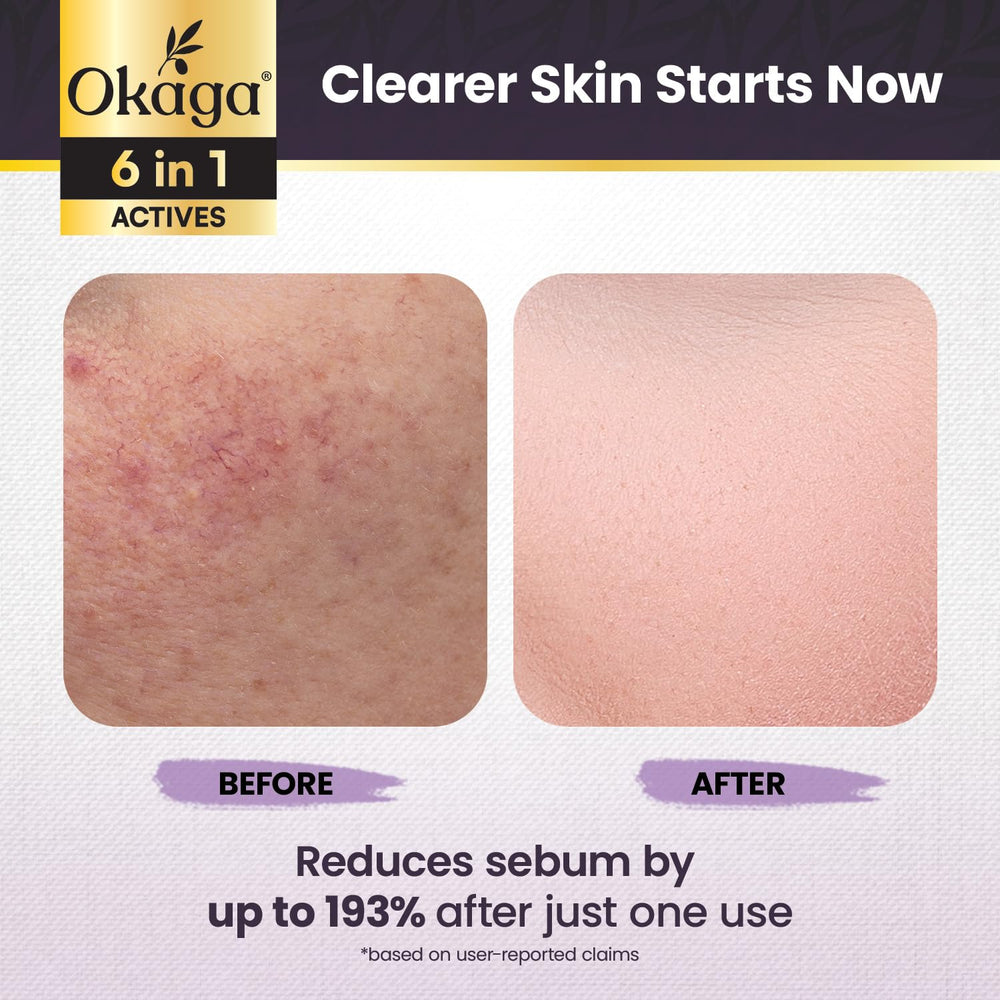 Okaga Argireline peptide action for firmer-looking skin and subtle plumpness