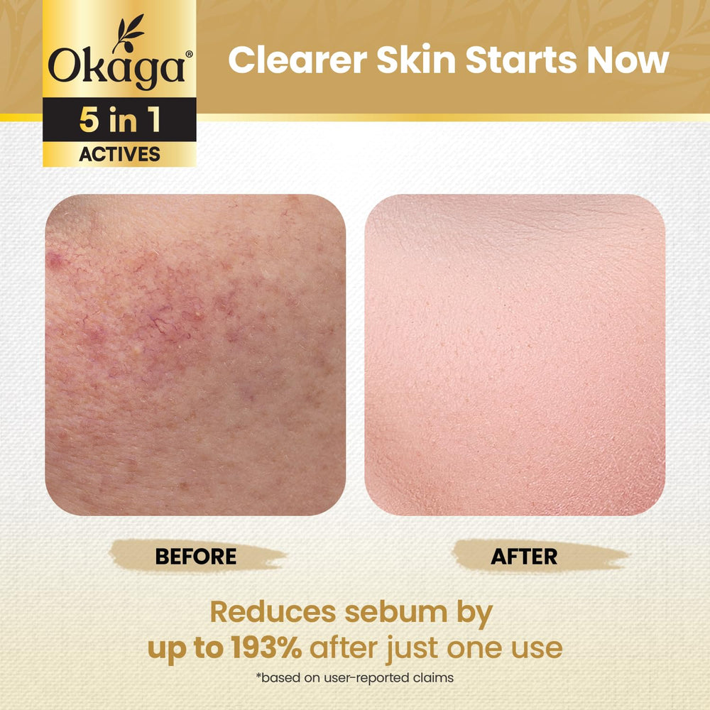 Okaga Rice Peel Shot Ampoule application on hand demonstrates easy daily use.