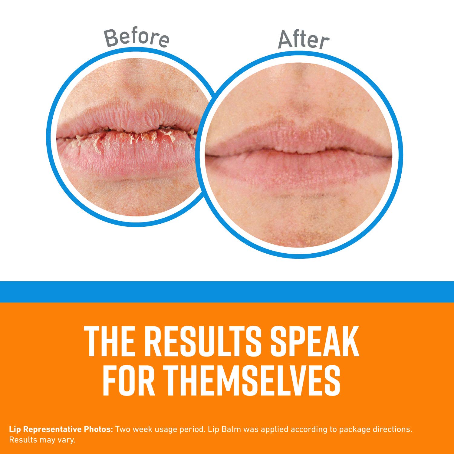 O'Keeffe's Lip Repair forms a moisture barrier on lips.