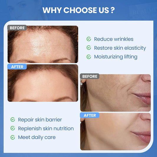 Okela smile line patches placed around the mouth for a refreshed morning look