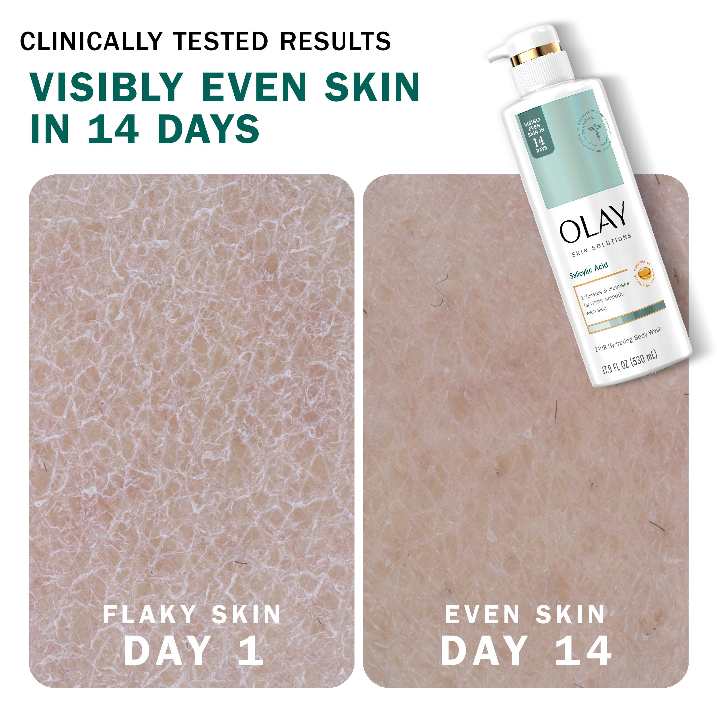 Salicylic acid detail on Olay Skin Solutions highlights gentle exfoliation.