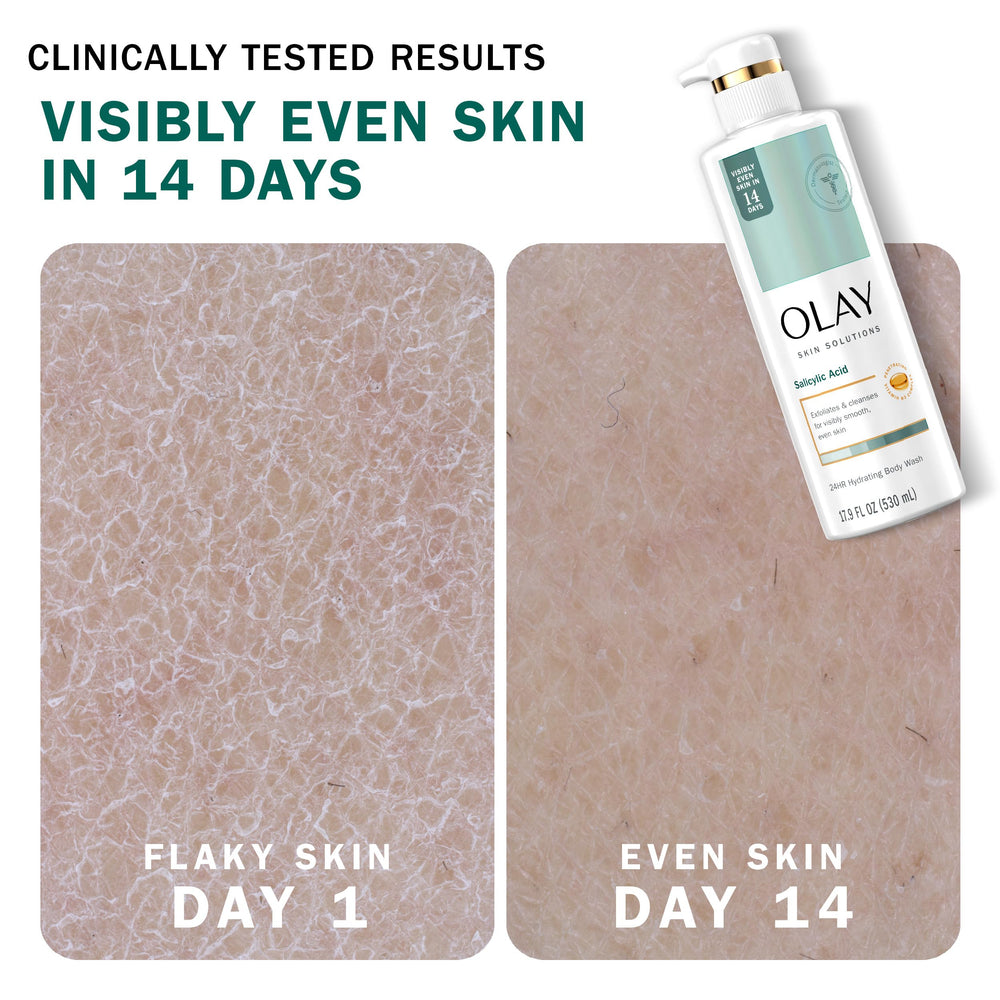 Salicylic acid detail on Olay Skin Solutions highlights gentle exfoliation.