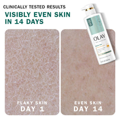 Salicylic acid detail on Olay Skin Solutions highlights gentle exfoliation.