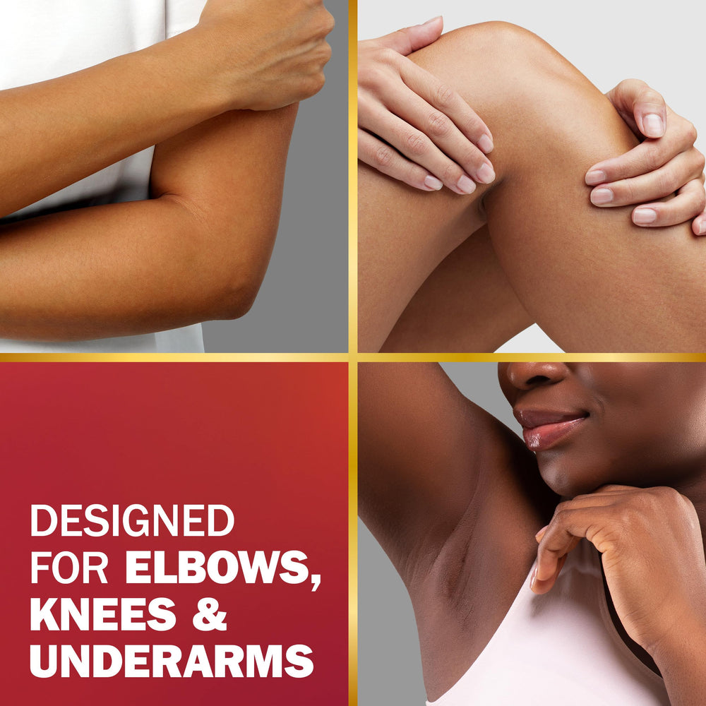 Olay Tone Correcting Cream applied to elbow area for smoother skin.