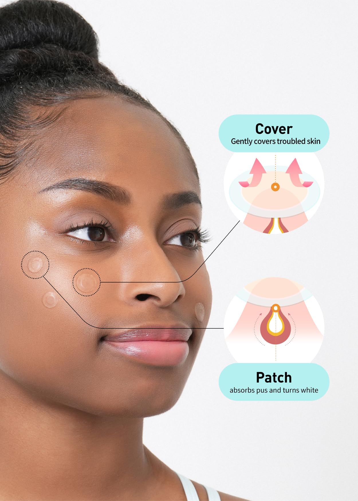 OLIVE YOUNG Care Plus Spot Patch adheres to skin with strong flat adhesion
