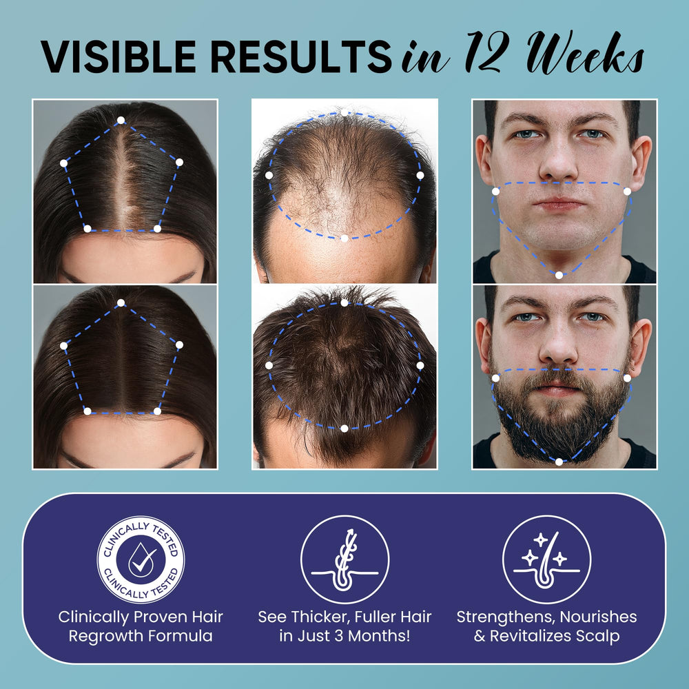 OLIVITA minoxidil spray application shows fast absorbing mist for quick routine