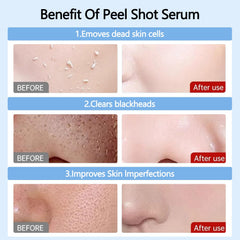 OLV Peel Shot Glow Rice Ampoule black bottle emphasizes pore-minimizing care.