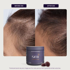 OMI Hair Growth Peptides Gummies ingredient list highlights essential vitamins for follicle support.