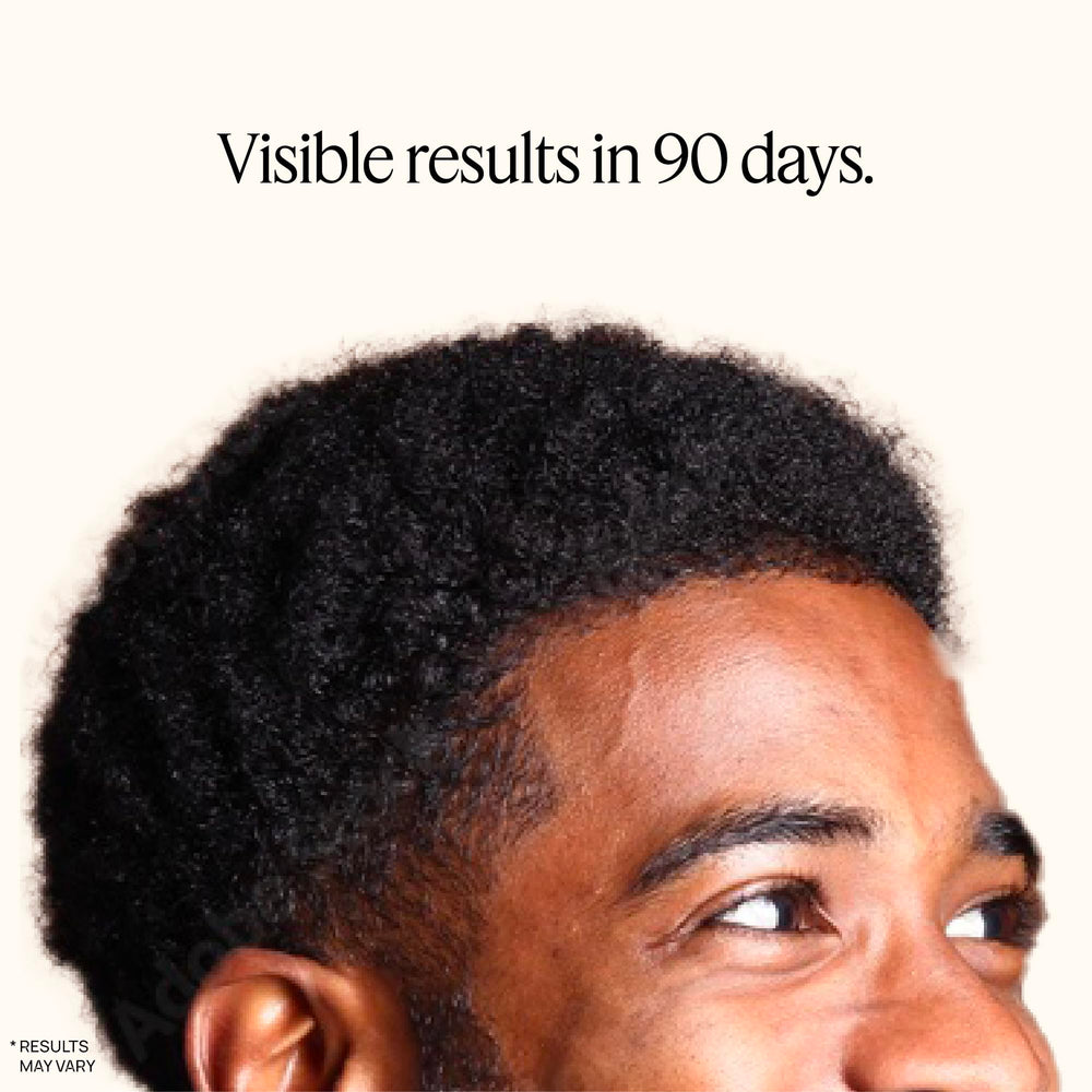 OMI WELLBEAUTY scalp follicle activation detail shows targeted coverage across the crown.