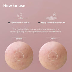 OMMA 72-pack display highlights strong adhesion for continuous blemish care