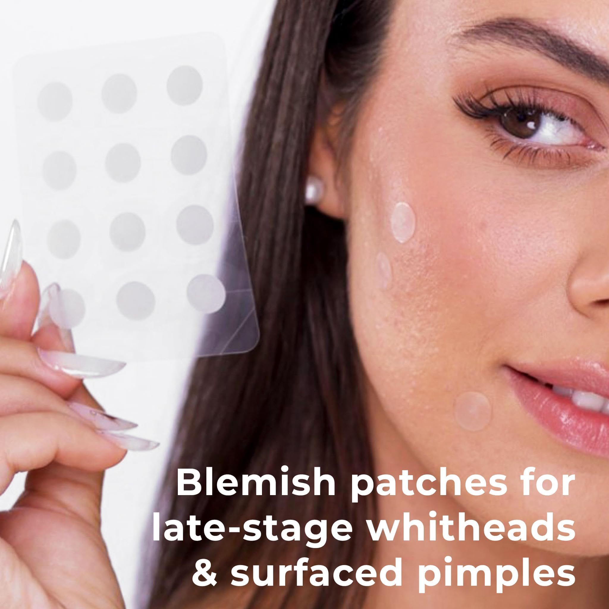 OMMA hydrocolloid patch adheres firmly to skin absorbing fluids for blemish care
