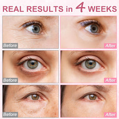 Omplen eye serum application with roller ready for daily use.