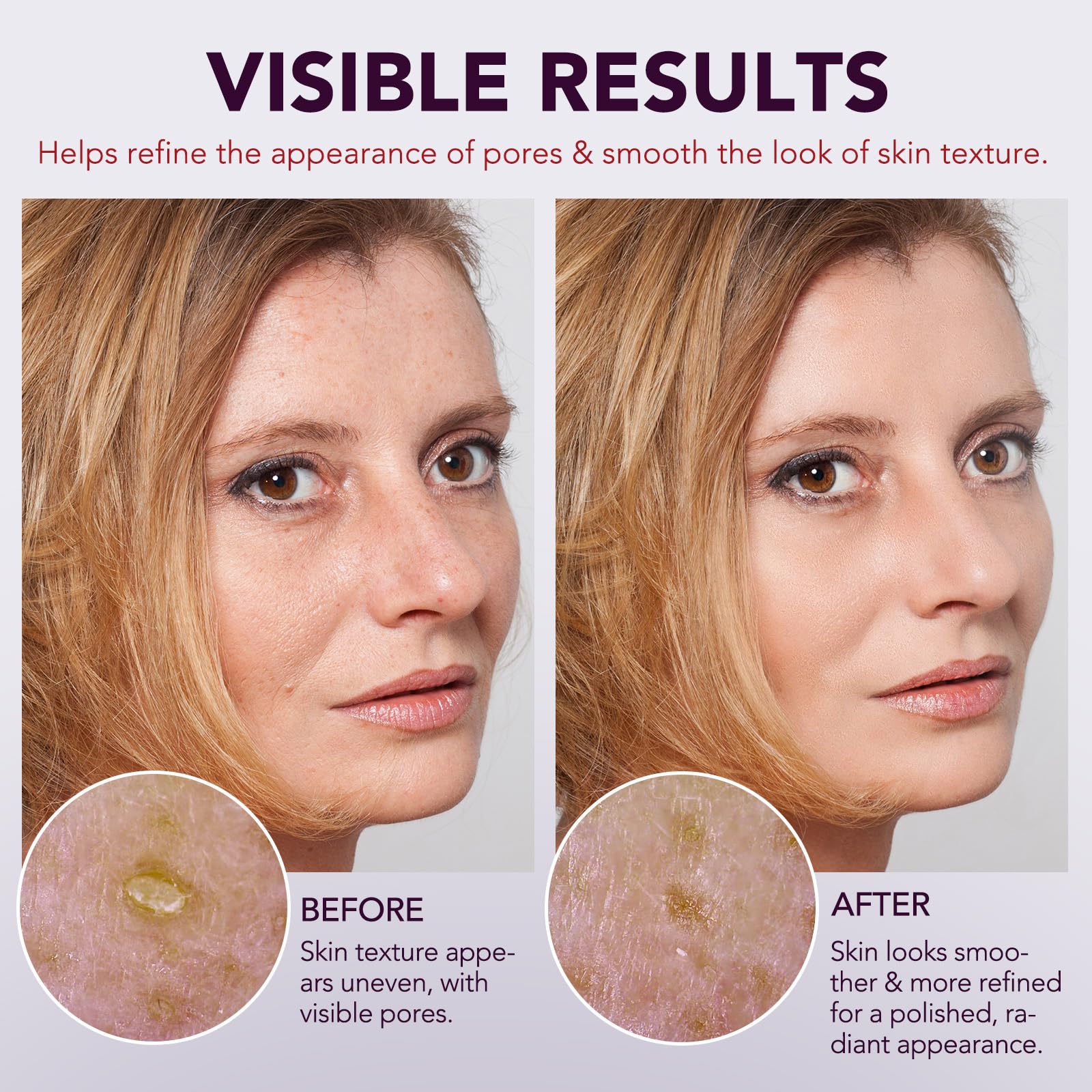 Close-up showing potential texture improvement and refined pores with OMZOK