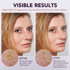 Close-up showing potential texture improvement and refined pores with OMZOK