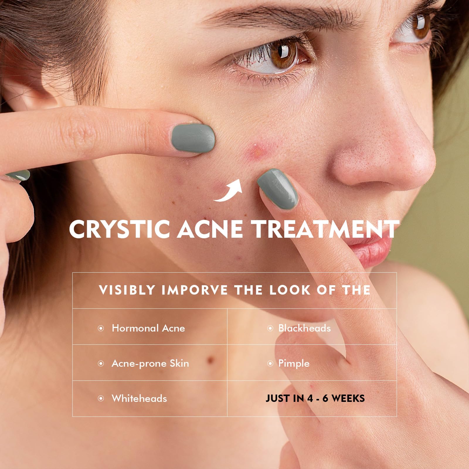 Onkessy Azelaic Acid Serum texture close-up highlighting essence-like absorption.
