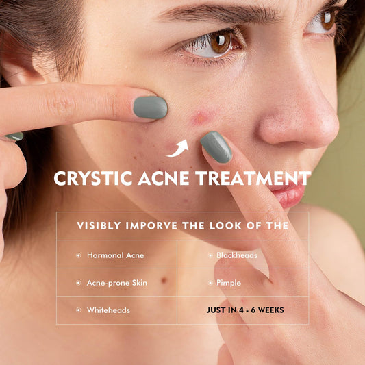 Onkessy Azelaic Acid Serum texture close-up highlighting essence-like absorption.
