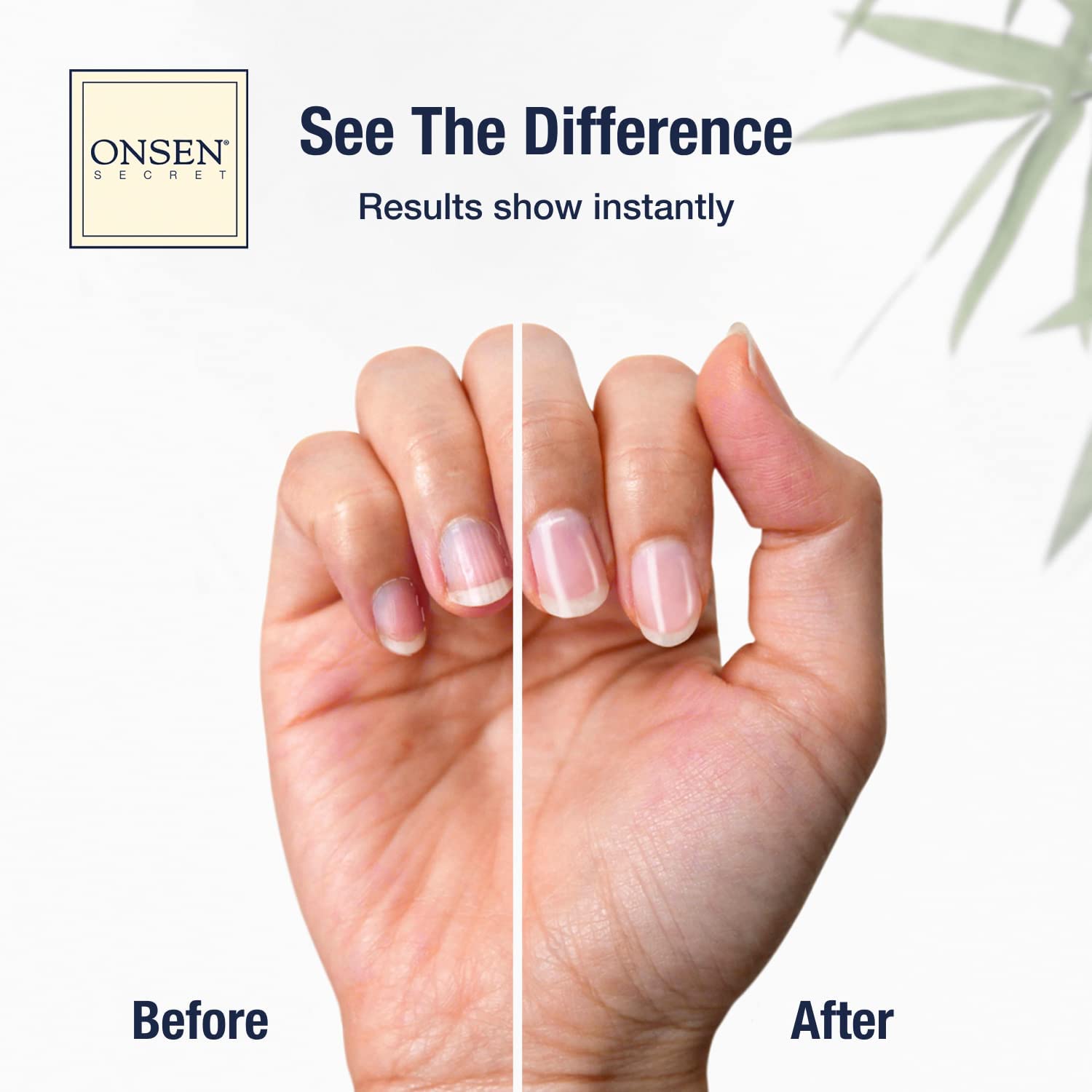 Onsen Secret mineral-rich nail care pack for healthier-looking nails.