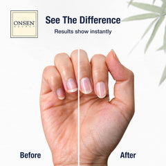 Onsen Secret mineral-rich nail care pack for healthier-looking nails.