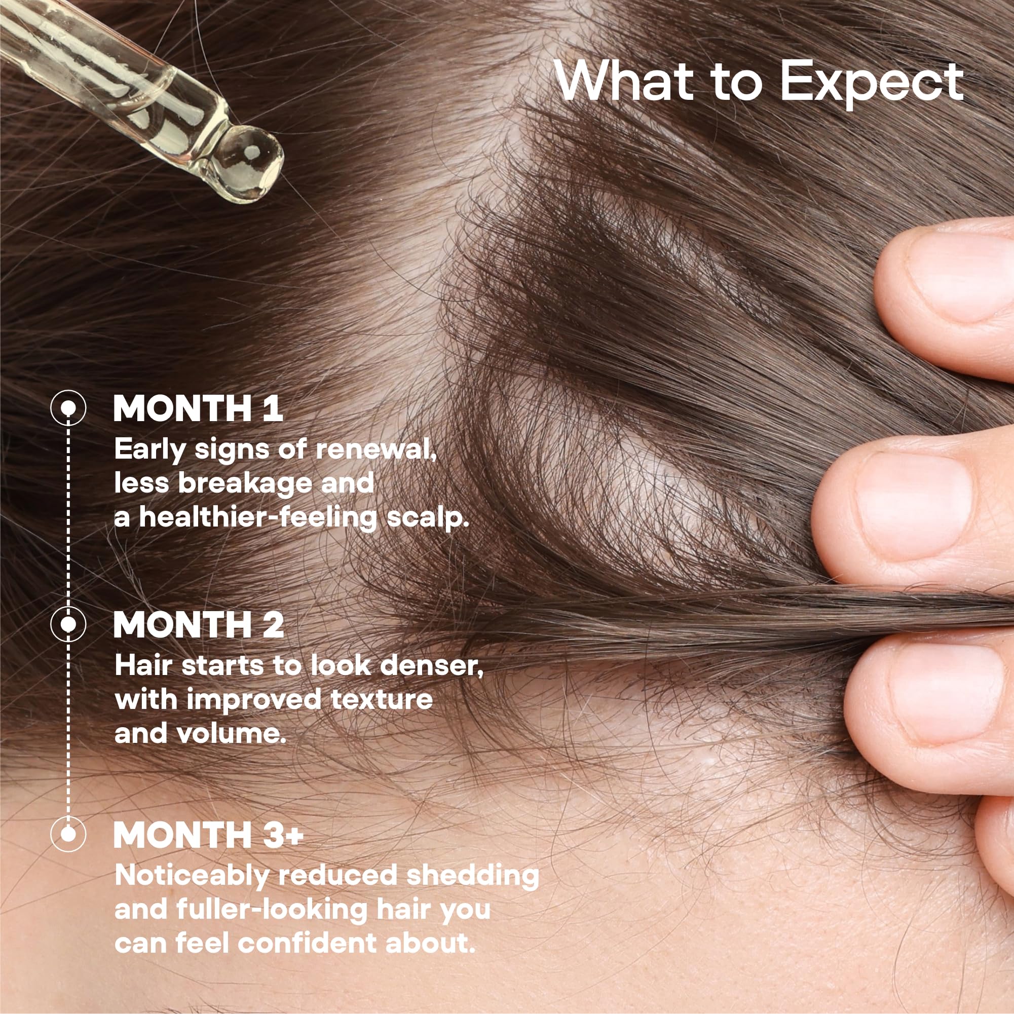 ONYX ProGro LactoPherma application point demonstrates targeted scalp coverage for even distribution.