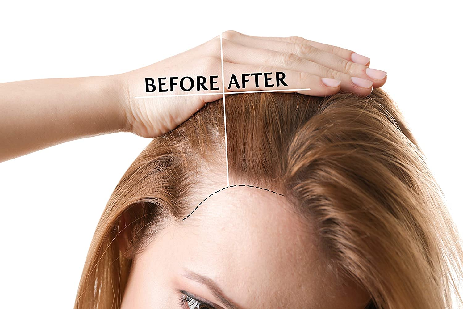 OPO Rice Water Hair Growth Mixture side view bottle on a clean surface