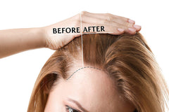 OPO Rice Water Hair Growth Mixture side view bottle on a clean surface