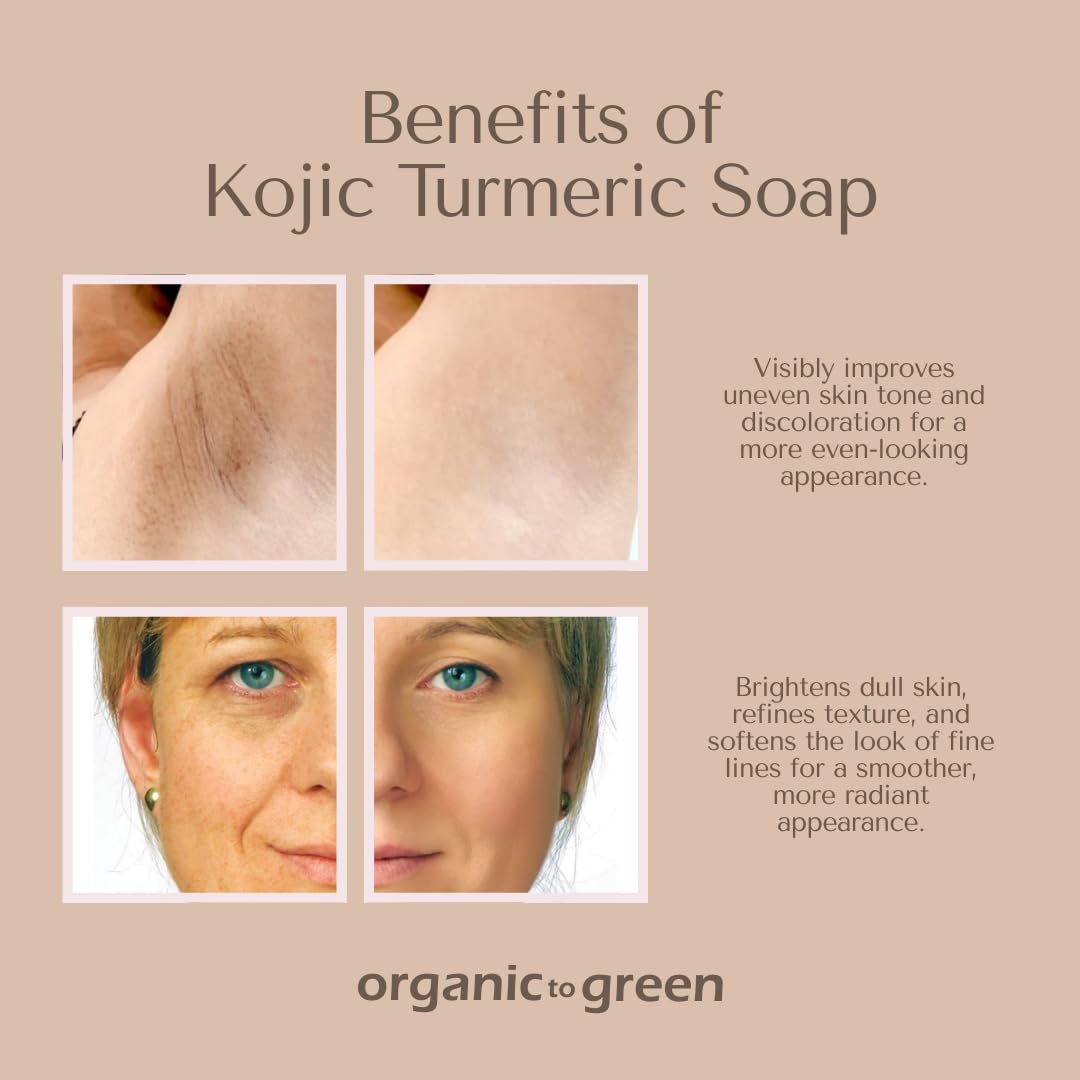 Organic To Green Kojic Turmeric Soap bar front view shows clean, inviting presentation for daily use.