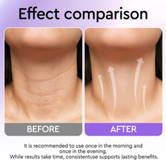 ORLASKIN Neck Cream texture swatch reveals lightweight, non greasy finish