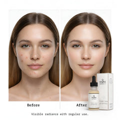 Orphi Radiance C Serum with hyaluronic acid provides lasting lightweight hydration.